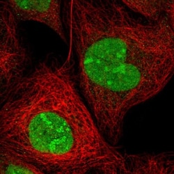 ZNF787 Antibody, Novus Biologicals:Antibodies:Primary Antibodies
